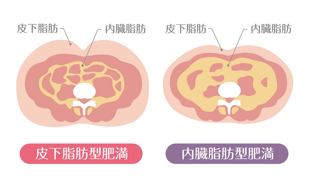 皮下脂肪と内臓脂肪